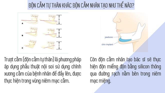 het got den don bang silicon, gio day chi em tim den phuong phap “truot” voi chinh cam cua minh! - 1